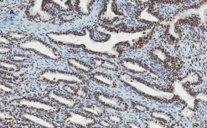 Anti-ATRX Antibody, clone 2A12, ZooMAb Rabbit Monoclonal 