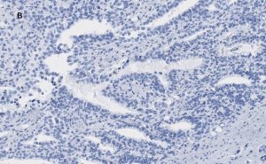 Anti-ATRX Antibody, clone 2A12, ZooMAb Rabbit Monoclonal 