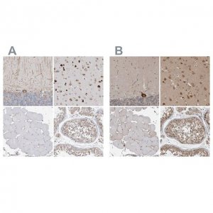 Anti-ATXN2 antibody produced in rabbit 