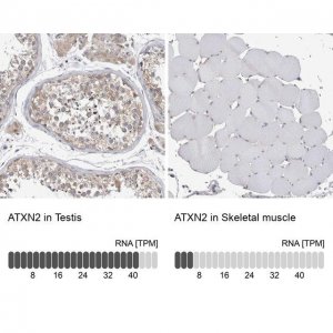 Anti-ATXN2 antibody produced in rabbit 