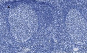 Anti-Aurora B Antibody, clone 7C4, ZooMAb Rabbit Monoclonal 
