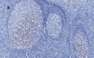 Anti-Aurora B Antibody, clone 7C4, ZooMAb Rabbit Monoclonal 