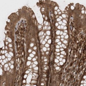 Anti-AVPI1 antibody produced in rabbit HPA037649-100UL
