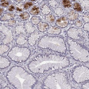 Anti-B3GNT6 antibody produced in rabbit 