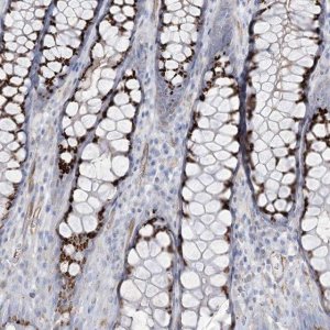 Anti-B3GNT7 antibody produced in rabbit 