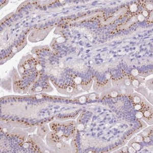 Anti-B3GNT8 antibody produced in rabbit 