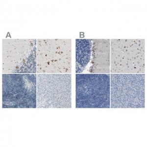 Anti-B4GALNT1 antibody produced in rabbit 