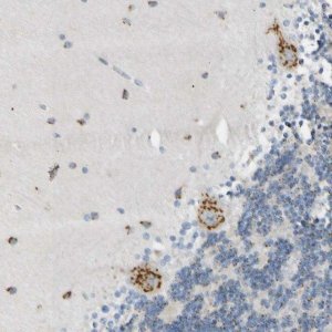 Anti-B4GALNT1 antibody produced in rabbit 