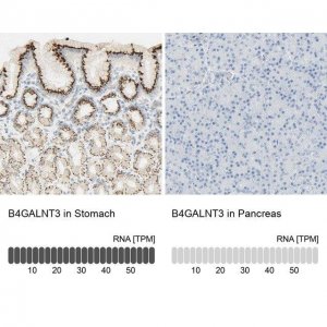 Anti-B4GALNT3 antibody produced in rabbit 