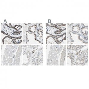 Anti-B4GALT1 antibody produced in rabbit 