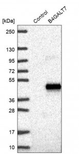 Anti-B4GALT7 antibody produced in rabbit 