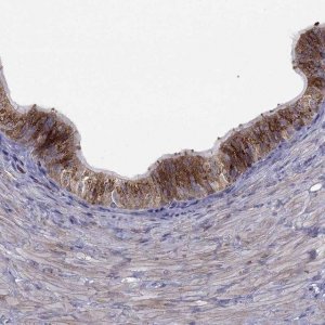 Anti-B4GALT7 antibody produced in rabbit 