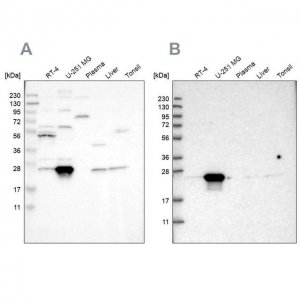 Anti-BAG2 antibody produced in rabbit 