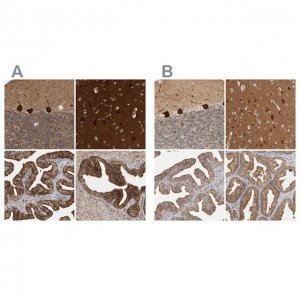 Anti-BAIAP2 antibody produced in rabbit 