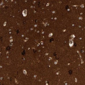 Anti-BAIAP2 antibody produced in rabbit 