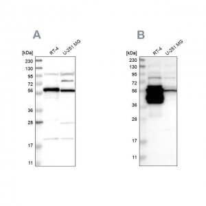 Anti-BAIAP2L1 antibody produced in rabbit 