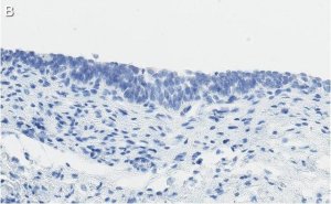 Anti-Bak Antibody, clone 2D18 ZooMAb Rabbit Monoclonal 