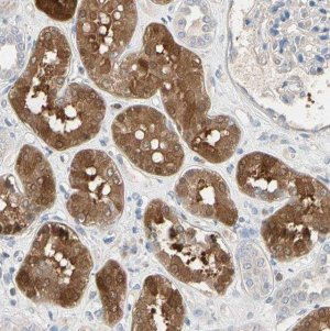 Anti-BBOX1 antibody produced in rabbit 
