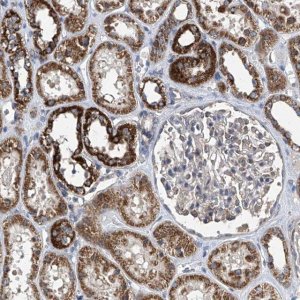 Anti-BCKDHB antibody produced in rabbit HPA031580-100UL