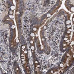 Anti-BCKDHB antibody produced in rabbit HPA031580-100UL