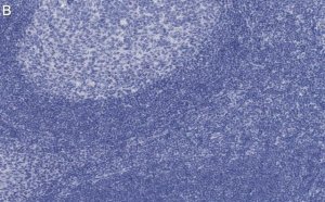 Anti-BCL-11A Antibody, clone 3B12 ZooMAb Rabbit Monoclonal 