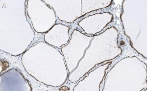 Anti-Bcl-2 Antibody, clone 1K8 ZooMAb Rabbit Monoclonal 
