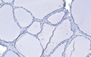 Anti-Bcl-2 Antibody, clone 1K8 ZooMAb Rabbit Monoclonal 