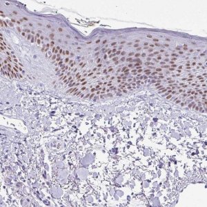 Anti-BCL11A antibody produced in rabbit 