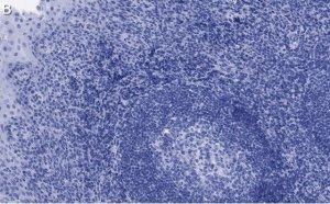 Anti-Bcl11A Antibody, clone 2C4 ZooMAb Rabbit Monoclonal 