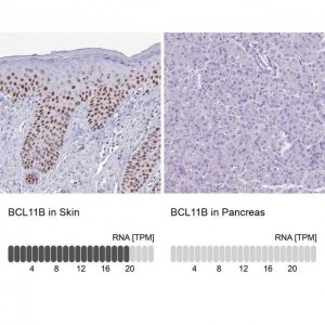 Anti-BCL11B antibody produced in rabbit 