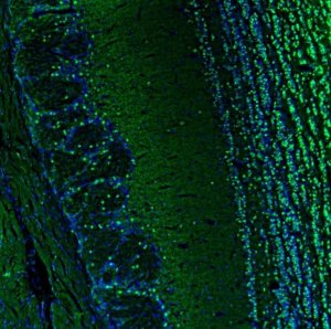 Anti-BCL11B antibody produced in rabbit 