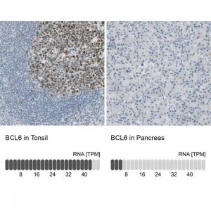 Anti-BCL6 antibody produced in rabbit 