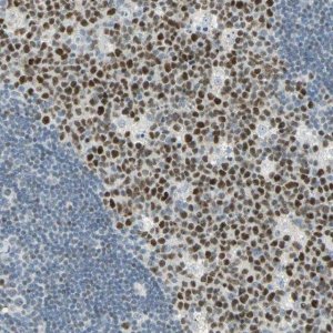 Anti-BCL6 antibody produced in rabbit 