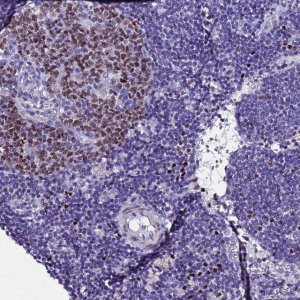 Anti-BCL7A antibody produced in rabbit 