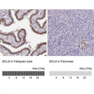 Anti-BCL9 antibody produced in rabbit 