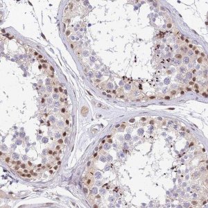 Anti-BCL9 antibody produced in rabbit 