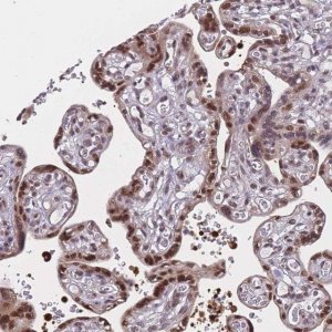 Anti-BCL9L antibody produced in rabbit 