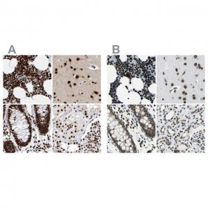 Anti-BCLAF1 antibody produced in rabbit 