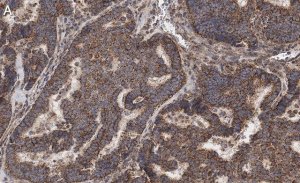 Anti-Beclin 1 Antibody, clone 1E22 , ZooMAb Rabbit Monoclonal 
