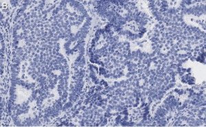 Anti-Beclin 1 Antibody, clone 1E22 , ZooMAb Rabbit Monoclonal 