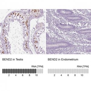 Anti-BEND2 antibody produced in rabbit HPA013142-100UL