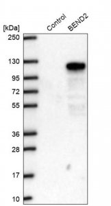 Anti-BEND2 antibody produced in rabbit HPA013142-100UL