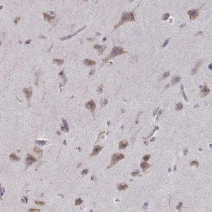 Anti-BEND6 antibody produced in rabbit 