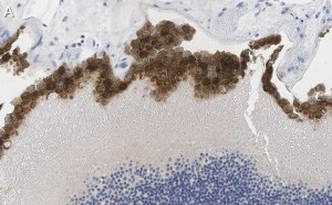 Anti-Bestrophin-1 Antibody, clone E6-6 ZooMAb Mouse Monoclonal 