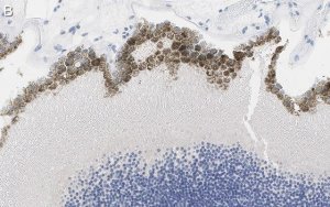 Anti-Bestrophin-1 Antibody, clone E6-6 ZooMAb Mouse Monoclonal 