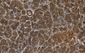 Anti-beta Catenin Antibody, clone 3J7, ZooMAb Rabbit Monoclonal 