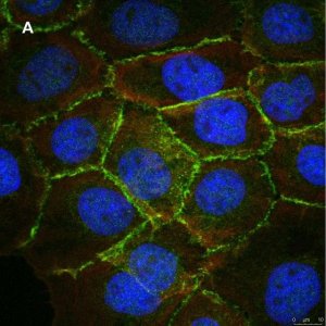 Anti-beta Catenin Antibody, clone 3J7, ZooMAb Rabbit Monoclonal 