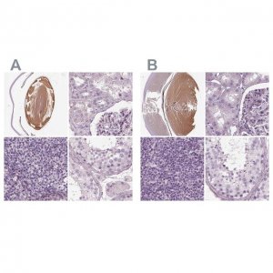 Anti-BFSP1 antibody produced in rabbit 