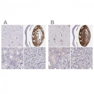 Anti-BFSP2 antibody produced in rabbit 