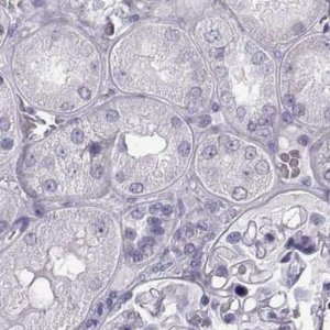 Anti-BFSP2 antibody produced in rabbit 